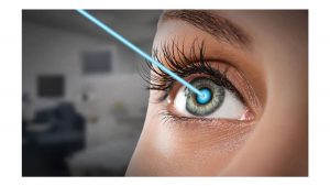 پزشکان متخصص لیزیک چشم در شیراز