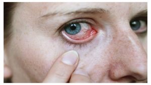 آشنایی با بیماری های شبکیه چشم و درمان آن