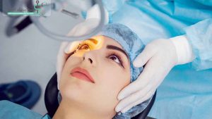 عمل لیزیک چشم چیست؟