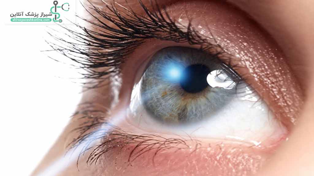 سونوگرافی چشم چیست؟