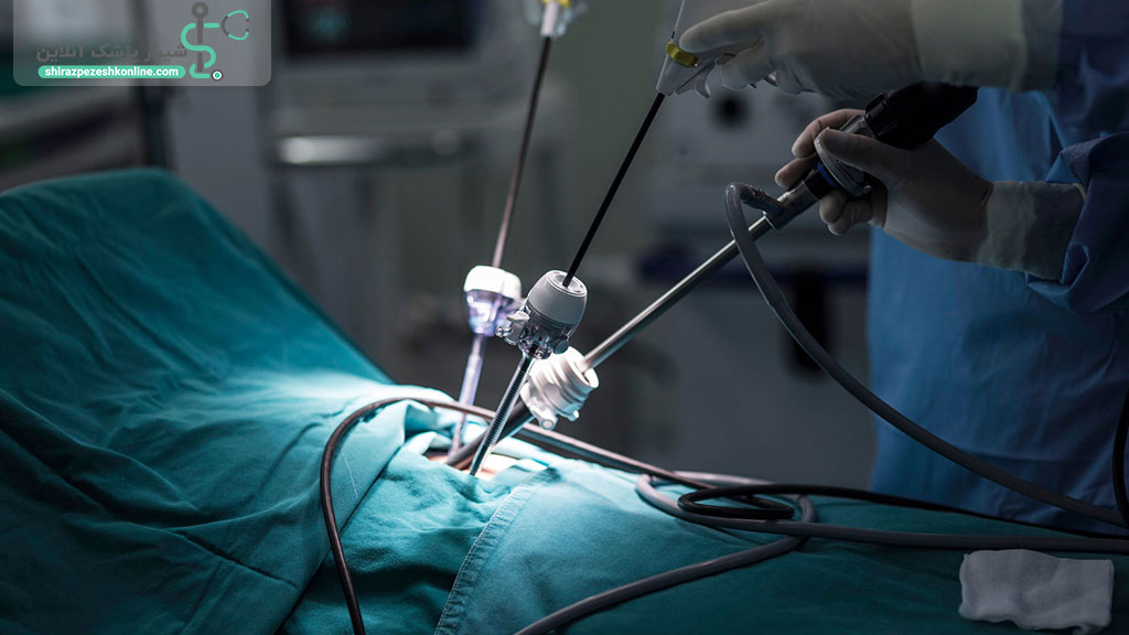 جراحی برداشتن رحم و هیسترکتومی در شیراز